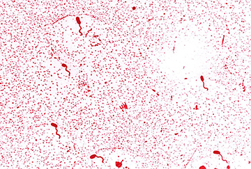 Photomicrograph of a flagella stain of <i>Vibrio cholerae</i> showing monotrichous arrangement of flagella.